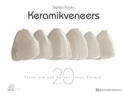 Keramikveneers: 20 Techniken für ästhetischen Erfolg (German Edition) (EPUB)