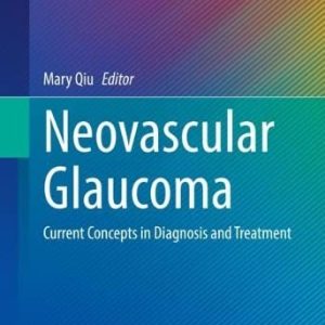 Neovascular Glaucoma: Current Concepts in Diagnosis and Treatment (Essentials in Ophthalmology) (Original PDF from Publisher)