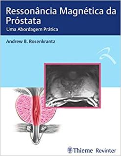 Ressonância Magnética da Próstata: Uma abordagem Prática (Original PDF from Publisher)