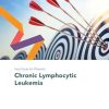 Fast Facts for Patients: Chronic Lymphocytic Leukemia (Original PDF from Publisher)