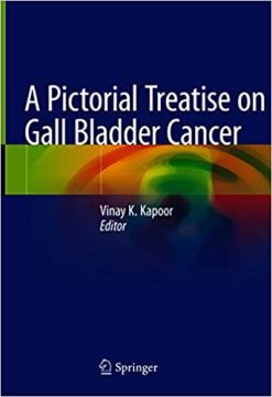 A Pictorial Treatise on Gall Bladder Cancer (Original PDF from Publisher)