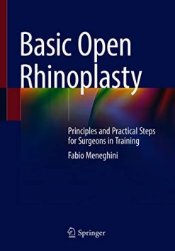Basic Open Rhinoplasty: Principles and Practical Steps for Surgeons in Training (Original PDF from Publisher)