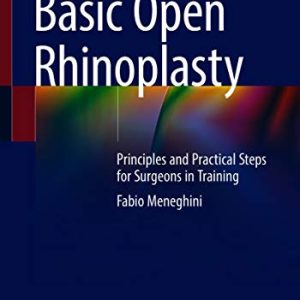 Basic Open Rhinoplasty: Principles and Practical Steps for Surgeons in Training (Original PDF from Publisher)