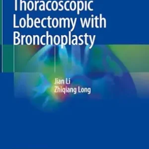 Atlas of Thoracoscopic Lobectomy with Bronchoplasty (Original PDF from Publisher)