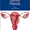 Uterine Fibroids (Reproductive Medicine and Assisted Reproductive Techniques) (Original PDF From Publisher+VIDEOS)