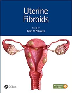Uterine Fibroids (Reproductive Medicine and Assisted Reproductive Techniques) (Original PDF From Publisher+VIDEOS)