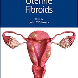 Uterine Fibroids (Reproductive Medicine and Assisted Reproductive Techniques) (Original PDF From Publisher+VIDEOS)