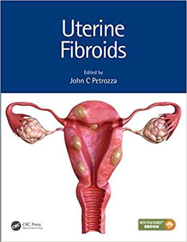 Uterine Fibroids (Reproductive Medicine and Assisted Reproductive Techniques) (Original PDF From Publisher+VIDEOS)
