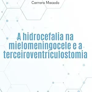 A hidrocefalia na mielomeningocele e a terceiroventriculostomia (Portuguese Edition) (EPUB)