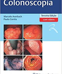 Colonoscopia, 3rd Edition (Original PDF from Publisher)