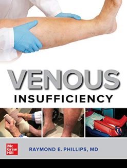 Venous Insufficiency (Original PDF from Publisher)