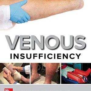 Venous Insufficiency (Original PDF from Publisher)