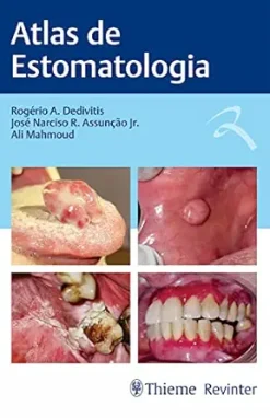 Atlas de Estomatologia (Portuguese Edition) (EPUB)