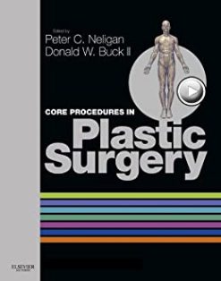 Core Procedures in Plastic Surgery, 1e (Videos)