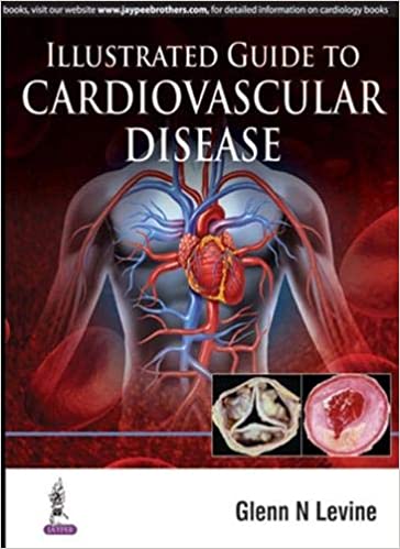 Illustrated Guide to Cardiovascular Disease (ORIGINAL PDF from Publisher)