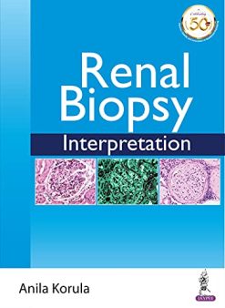 Renal Biopsy Interpretation (Original PDF from Publisher)
