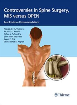 Controversies in Spine Surgery, MIS versus OPEN: Best Evidence Recommendations (Original PDF from Publisher)