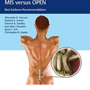 Controversies in Spine Surgery, MIS versus OPEN: Best Evidence Recommendations (Original PDF from Publisher)