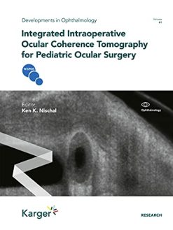 Integrated Intraoperative Ocular Coherence Tomography for Pediatric Ocular Surgery (Original PDF from Publisher)