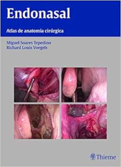 Endonasal: Atlas de Anatomia Cirúrgica, 1st Edition (Original PDF from Publisher)