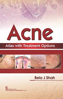 Acne Atlas with Treatment Options (Original PDF from Publisher)