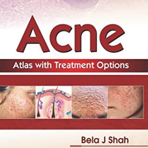 Acne Atlas with Treatment Options (Original PDF from Publisher)