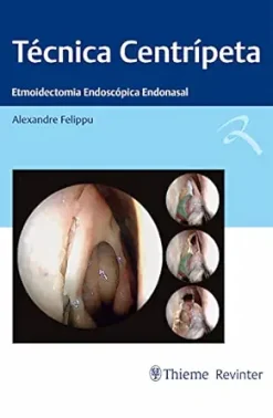 Técnica Centrípeta: Etmoidectomia Endoscópica Endonasal (Portuguese Edition) (EPUB)