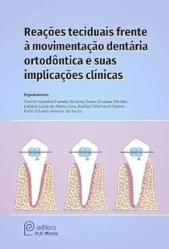 Reações teciduais frente à movimentação dentária ortodóntica e suas implicações clínicas (Portuguese Edition) (EPUB)