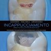 Incappucciamento diretto della polpa dentale: Procedure e tecniche operative per preservare la vitalità pulpare (EPUB)