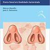 Rinoplastia: Ponta Nasal em Realidade Aumentada (Original PDF from Publisher)