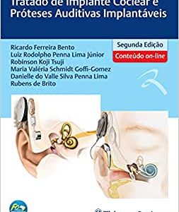 Tratado de Implante Coclear e Próteses Auditivas Implantáveis, 2nd Edition (EPUB)