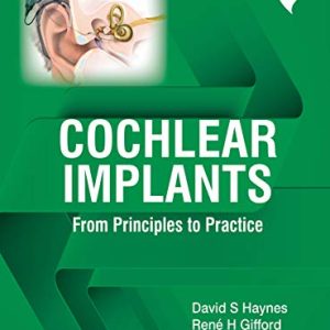 Cochlear Implants: From Principles to Practice (Original PDF from Publisher)