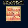 Atlas of capillaroscopy in rheumatic diseases (Original PDF from Publisher)