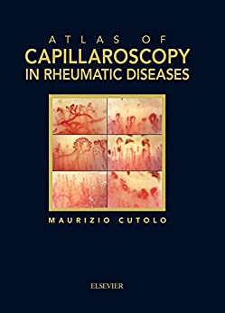 Atlas of capillaroscopy in rheumatic diseases (Original PDF from Publisher)