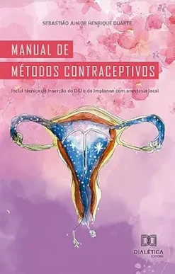 Manual de métodos contraceptivos: inclui técnica de inserção do DIU e do Implanon com anestesia local (Portuguese Edition) (EPUB)