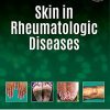 Skin In Rheumatologic Diseases (Original PDF from Publisher)