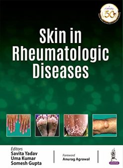 Skin In Rheumatologic Diseases (Original PDF from Publisher)