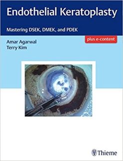 Endothelial Keratoplasty: Mastering DSEK, DMEK, and PDEK (PDF)