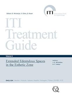 Extended Edentulous Spaces in the Esthetic Zone (ITI Treatment Guide Series Book 6) (EPUB)