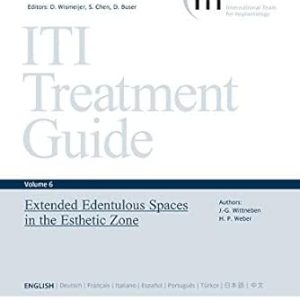 Extended Edentulous Spaces in the Esthetic Zone (ITI Treatment Guide Series Book 6) (EPUB)