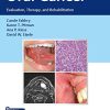 Oral Cancer: Evaluation, Therapy, and Rehabilitation (Original PDF from Publisher)