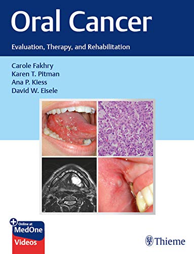 Oral Cancer: Evaluation, Therapy, and Rehabilitation (Original PDF from Publisher)