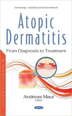 Atopic Dermatitis: From Diagnosis to Treatment (Original PDF from Publisher)