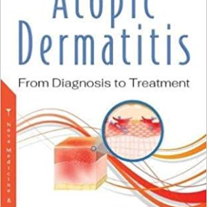Atopic Dermatitis: From Diagnosis to Treatment (Original PDF from Publisher)