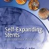 Self-Expanding Stents in Gastrointestinal Endoscopy (Original PDF from Publisher)
