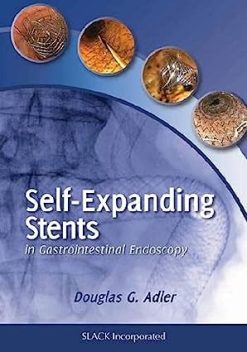 Self-Expanding Stents in Gastrointestinal Endoscopy (Original PDF from Publisher)