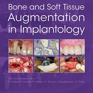 Bone and Soft Tissue Augmentation in Implantology (Original PDF from Publisher)