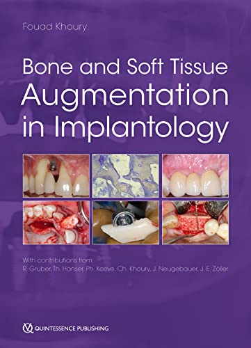 Bone and Soft Tissue Augmentation in Implantology (Original PDF from Publisher)