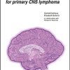 Current treatment concepts for primary CNS lymphoma (UNI-MED Science) (Original PDF from Publisher)