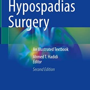 Hypospadias Surgery: An Illustrated Textbook, 2nd Edition (Original PDF from Publisher)